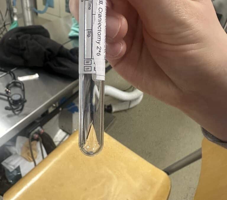 a person holding a tube