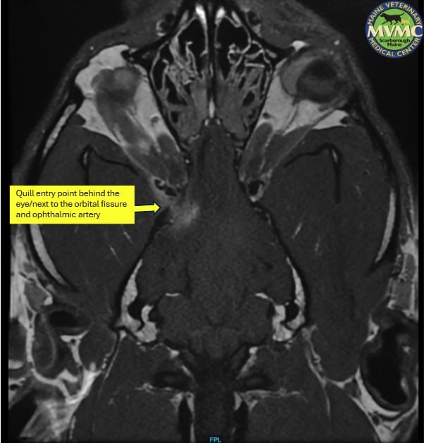 CT Scan